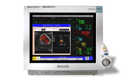 patient monitors
